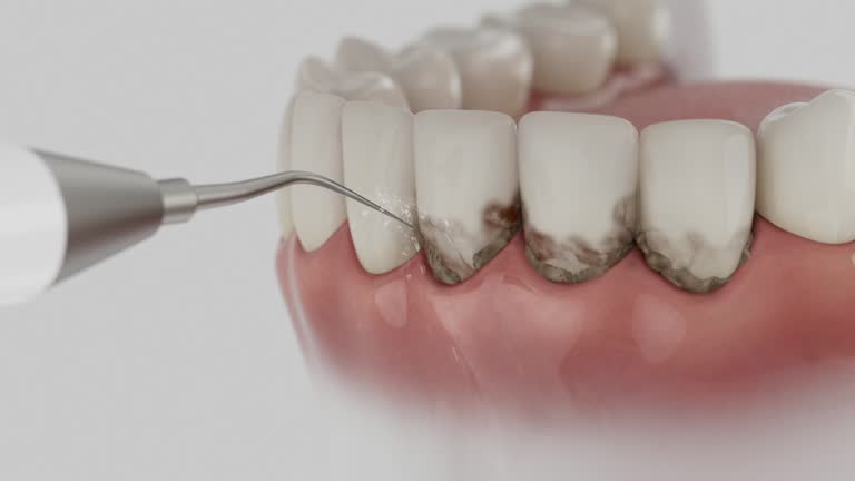 Trusted Dental Crowns And Bridges service in Myrtle Beach, SC - Dentist Open Now